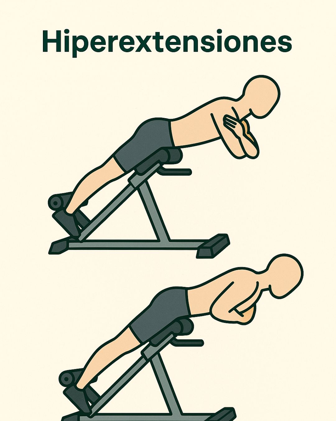 Hiperextensiones lumbares